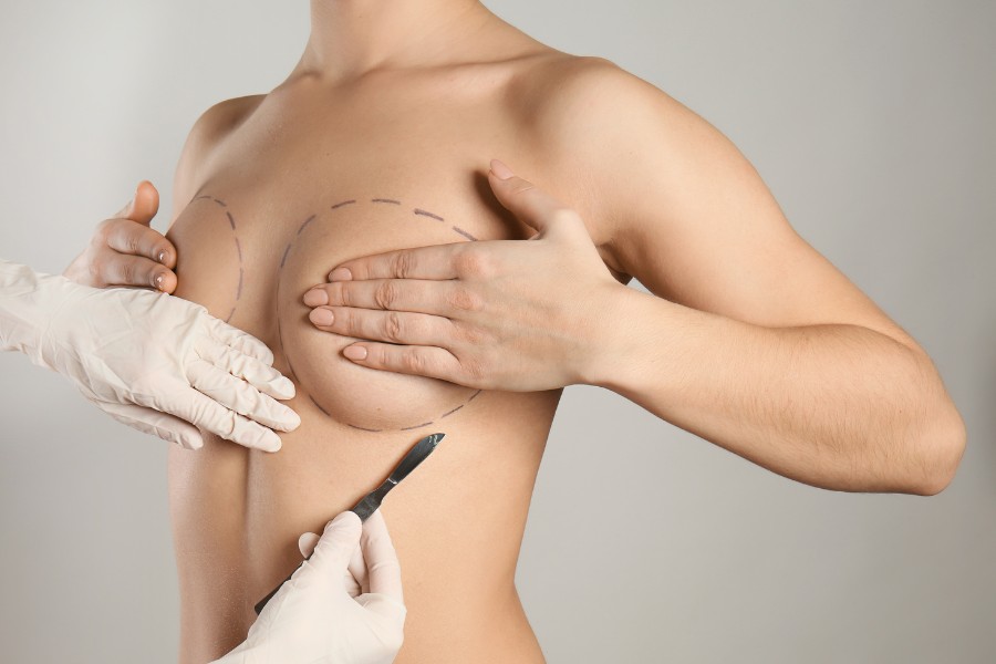 Nâng ngực nội soi giúp cải thiện bầu ngực căng tròn