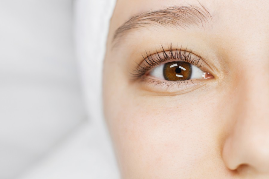Việc lấy mỡ mắt có thành sẹo hay không còn phụ thuộc rất lớn vào quá trình chăm sóc hậu phẫu của bạn