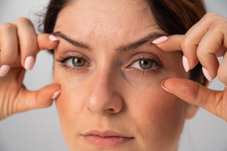 Nguyên nhân gây mỡ mí mắt trên? Khi nào nên lấy mỡ mắt?