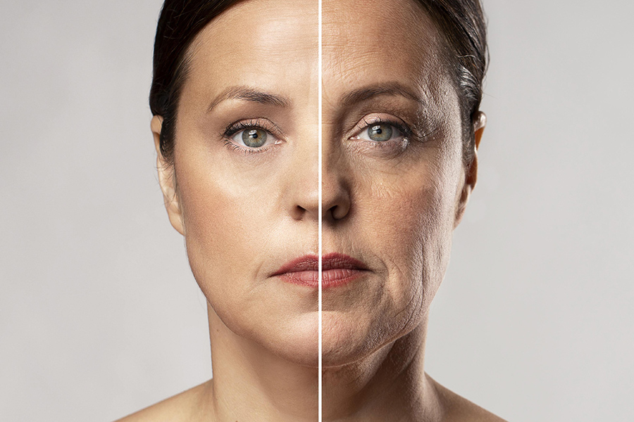 Căng chỉ collagen ngày giúp đẩy lùi tuổi tác và làm chậm quá trình lão hóa