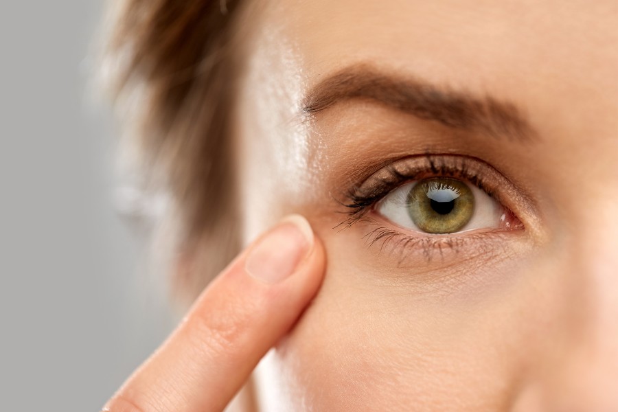 Yếu tố cơ địa có tác động mạnh mẽ đến thời gian duy trì mí mắt sau phẫu thuật