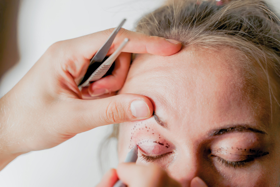 Phẫu thuật thẩm mỹ mắt nai an toàn, hiệu quả