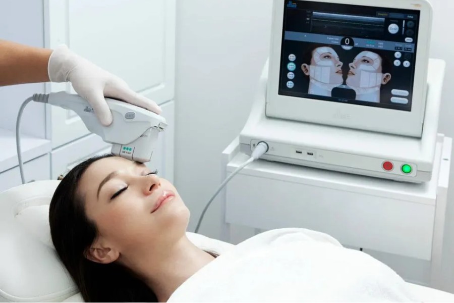 Giá căng da mặt với công nghệ Ultherapy