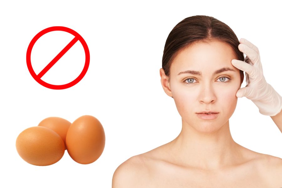 Cắt mí kiêng trứng bao lâu? Lỡ ăn trứng có bị sao không?