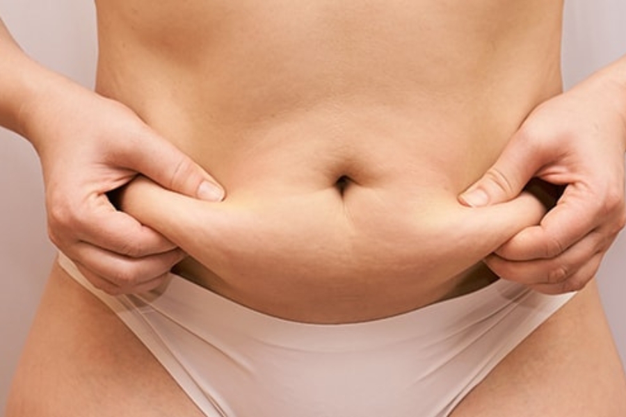 Người ít da thừa vùng bụng thích hợp để căng da bụng mini