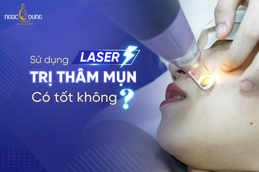 Review kết quả điều trị thâm mụn tại Hệ thống TMV Ngọc Dung 