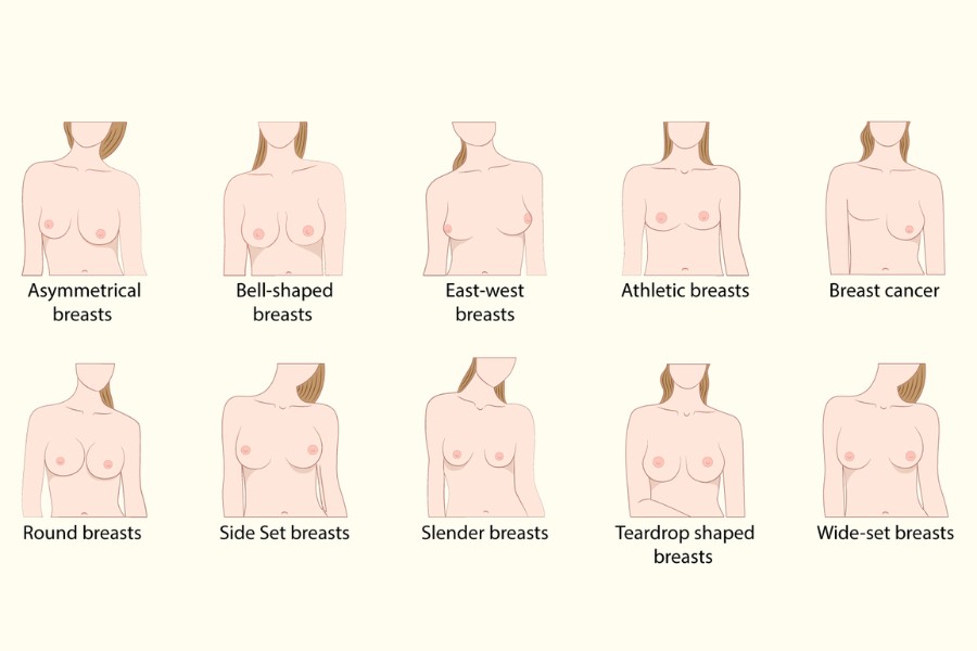Tìm hiểu các dáng ngực phổ biến và cách sở hữu vòng 1 chuẩn