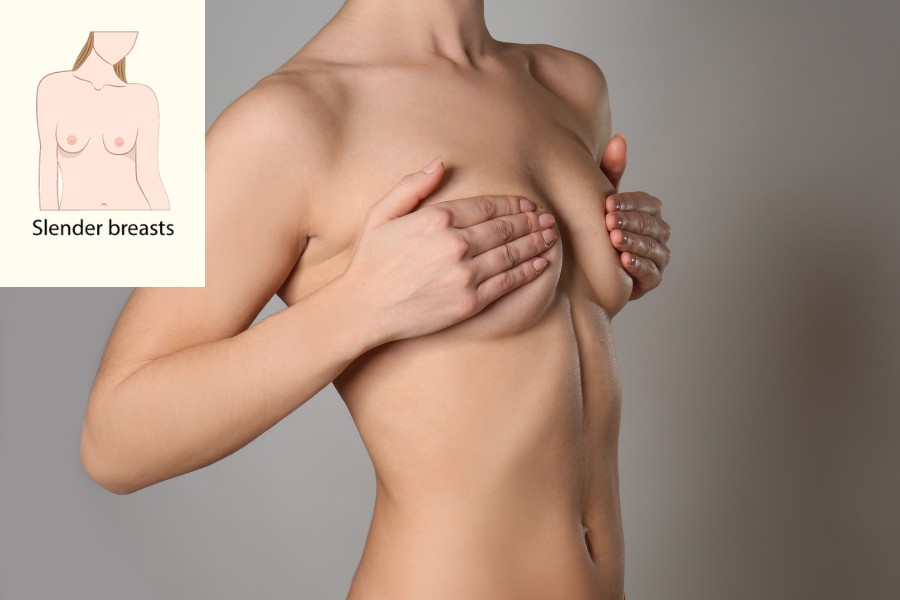 Dáng ngực Slender có phần thềm ngực mỏng nhưng đầy đặn ở phần bầu ngực dưới